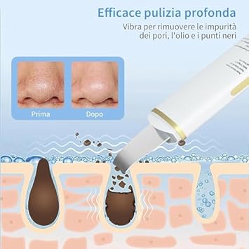 Épurateur Ultrasonique de Peau Soin Visage, avec fonction exfoliante et massage avec Charge USB