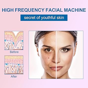 Appareil Haute Fréquence avec 4 Rouge Neon, Haute Fréquence Portable Outils de Beauté Faciale Visage Baguette pour Réduire Les Rides, Les Yeux Gonflés, Les Cernes, La Perte de Cheveux