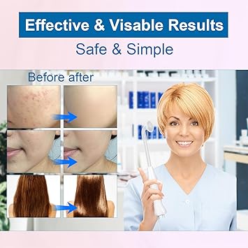 Appareil Haute Fréquence avec 4 Rouge Neon, Haute Fréquence Portable Outils de Beauté Faciale Visage Baguette pour Réduire Les Rides, Les Yeux Gonflés, Les Cernes, La Perte de Cheveux